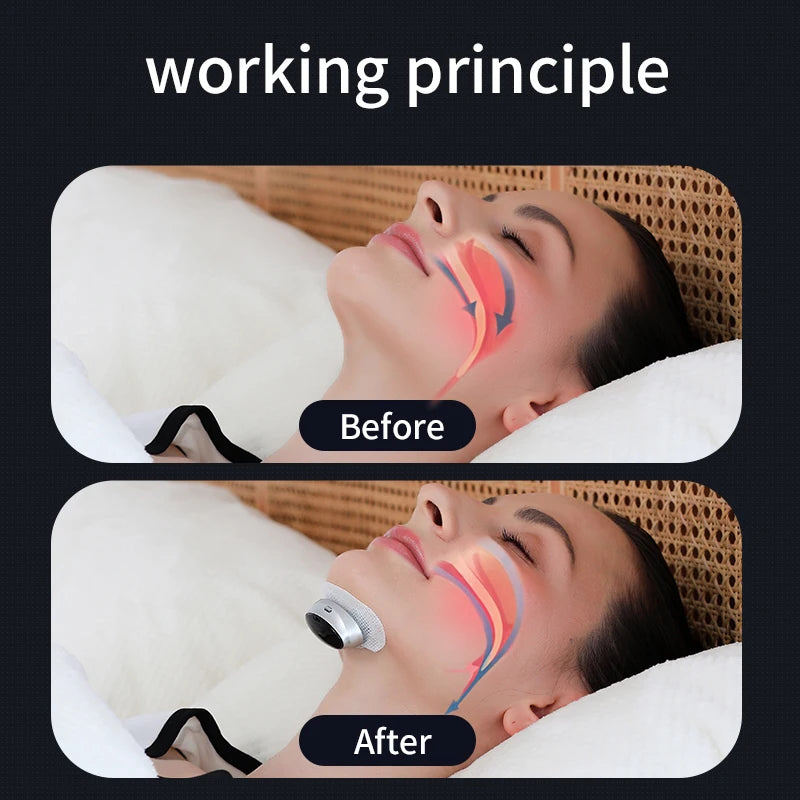 New Smart anti Snoring Device Stop Snoring Dual Pulse Muscle Stimulator